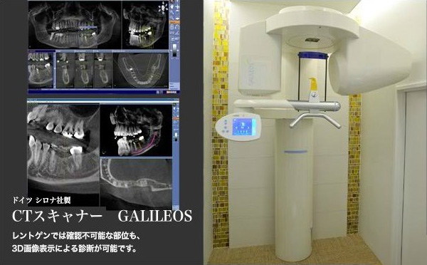 ドイツシロナ社製CTスキャナー GALILEOS